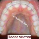 ���������������� ������ ����� - ����������� 3