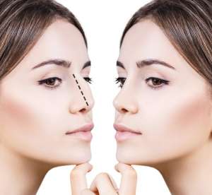 ����������������� ����. �������� �� �������� ���� � ����� - ����������� 1