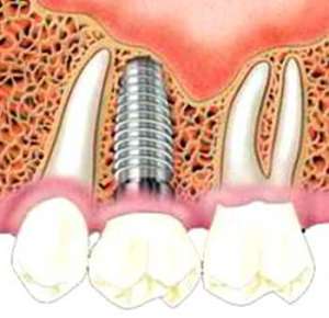 ����������-����������� - ����������� 1